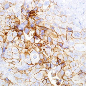 Thrombomodulin