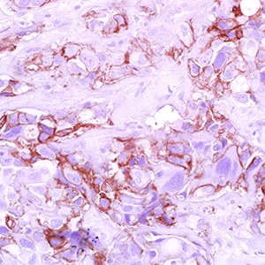 Thrombomodulin