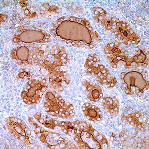 Thyroglobulin, 2Н11+6Е1, mouse