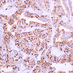 Thyroglobulin, 2Н11+6Е1, mouse