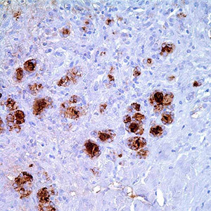 Thyroglobulin, MRQ-41, mouse