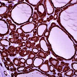 Thyroid Peroxidase