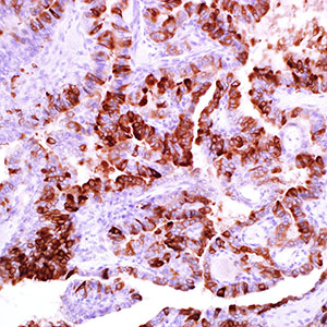 Thyroid Peroxidase