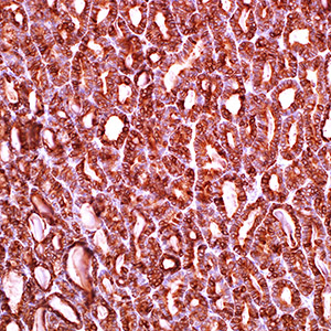 Thyroid Peroxidase
