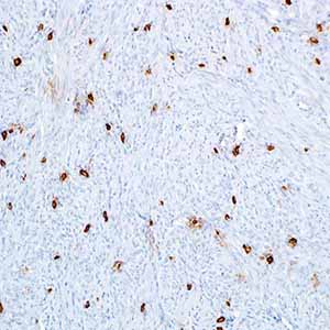 Tryptase