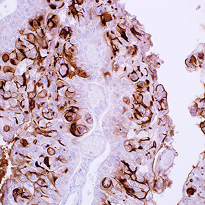 Uroplakin III, AU-1, mouse