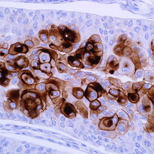 Uroplakin III, AU-1, mouse