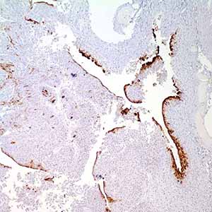 Uroplakin III, SP73, rabbit
