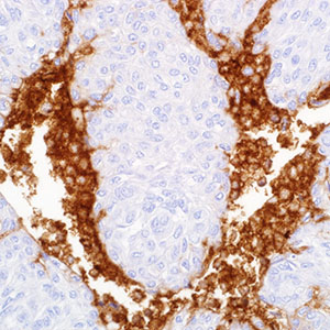 Uroplakin III, SP73, rabbit