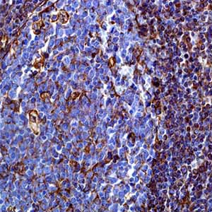 Vimentin, SP20, rabbit