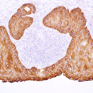 Cytokeratin 17