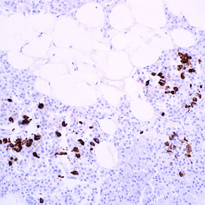 Somatostatin