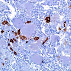 Calcitonin, SP17, rabbit
