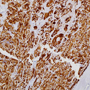 Calcitonin, SP17, rabbit