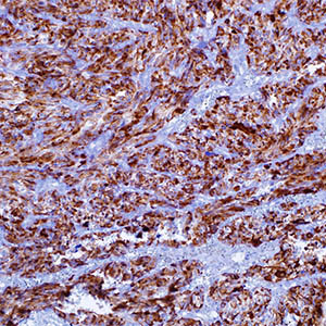 Calcitonin, SP17, rabbit