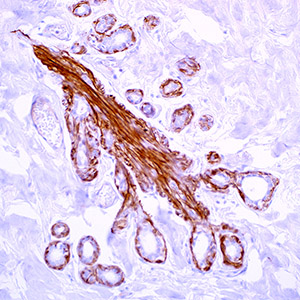 Calponin-1