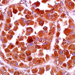 Cathepsin K