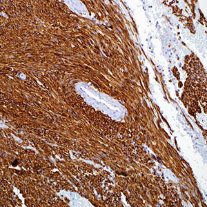 CD117, c-kit
