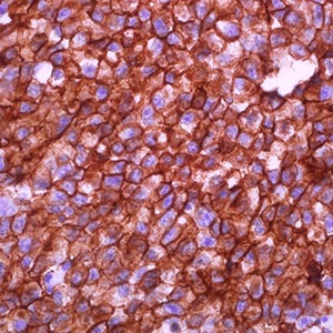 CD117, c-kit