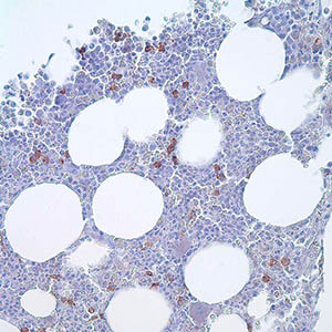 CD14