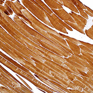 Actin, Muscle Specific