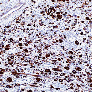 Actin, Muscle Specific