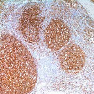 CD19