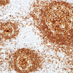 CD19