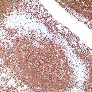 CD20, L26, mouse