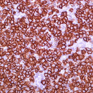 CD20, L26, mouse