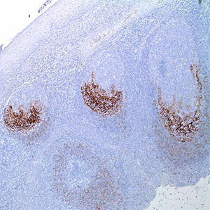 CD23, 1B12, mouse