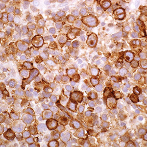 CD25