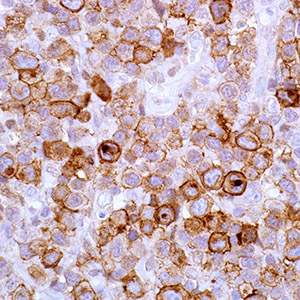CD25