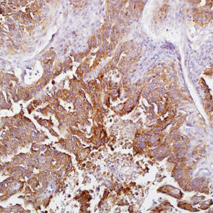 CD30