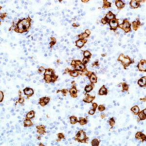 CD30