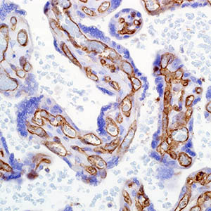 CD31