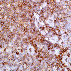 CD43, SP55, rabbit
