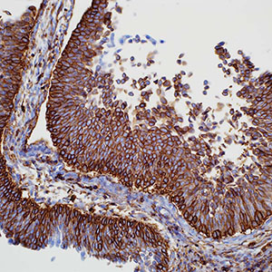 CD44