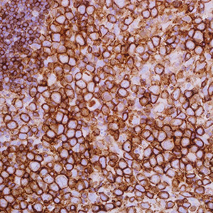 CD45