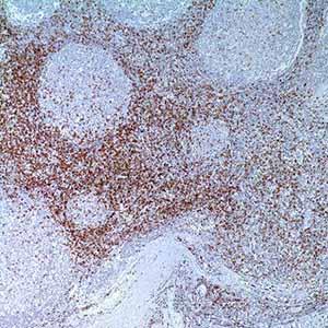 CD45RO