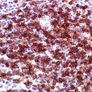 CD45RO
