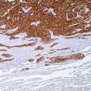 CD56, 123C3.D5, mouse