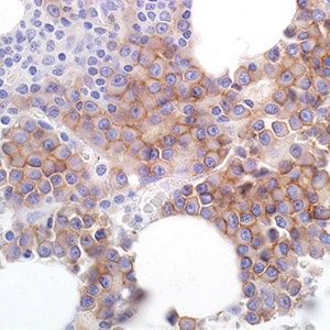 CD56, 123C3.D5, mouse