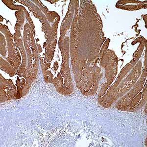 CEA, рolyclonal, rabbit