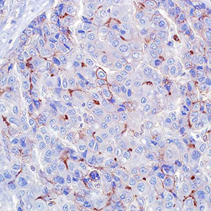 CEA, рolyclonal, rabbit