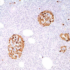 Chromogranin A