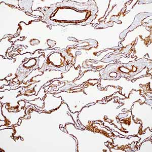 Collagen Type IV