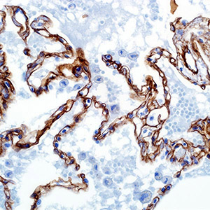 Collagen Type IV