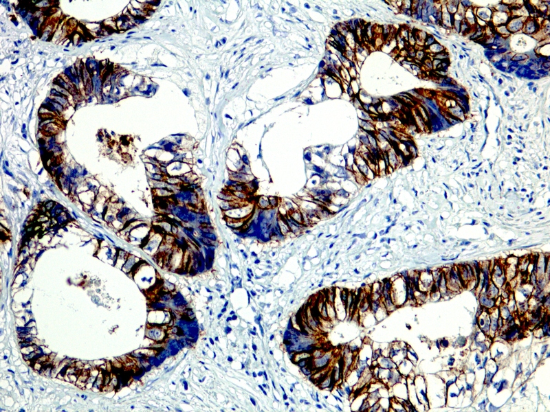LI-Cadherin