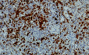 Lysozyme